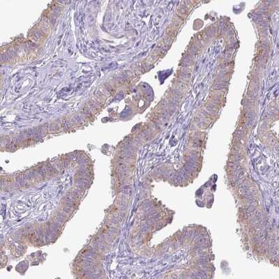 Immunohistochemistry-Paraffin: GALNT12 Antibody [NBP2-14035] - Staining of human fallopian tube shows low expression as expected.