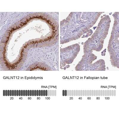 <b>Orthogonal Strategies Validation. </b>Immunohistochemistry-Paraffin: GALNT12 Antibody [NBP2-14035] - Staining in human epididymis and fallopian tube tissues using anti-GALNT12 antibody. Corresponding GALNT12 RNA-seq data are presented for the same tissues.