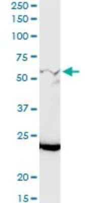 Western Blot GALNT12 Antibody