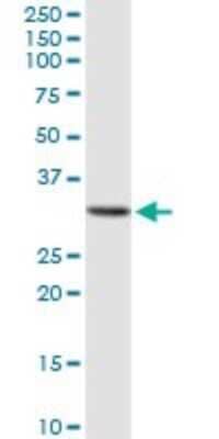 Western Blot GALNT12 Antibody