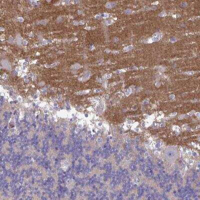 Immunohistochemistry-Paraffin: GALNT13 Antibody [NBP2-31837] - Staining of human cerebellum shows moderate positivity in the neuropil of the molecular layer.