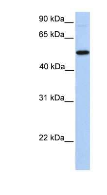 Western Blot: GALNT13 Antibody [NBP1-62619] - Hela cell lysate, concentration 0.2-1 ug/ml.