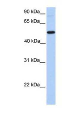 Western Blot: GALNT13 Antibody [NBP1-69624] - This Anti-GALNT13 antibody was used in Western Blot of Hela tissue lysate at a concentration of 1ug/ml.