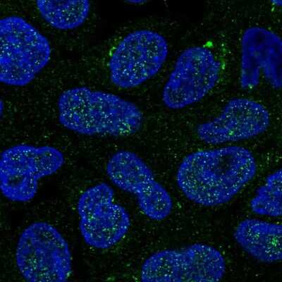 Immunocytochemistry/Immunofluorescence: GALNT14 Antibody [NBP2-56187] - Staining of human cell line RT4 shows localization to nucleus & the Golgi apparatus.