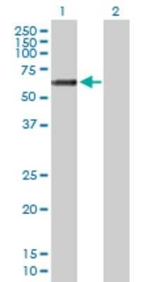 Western Blot: GALNT14 Antibody [H00079623-B01P] - Analysis of GALNT14 expression in transfected 293T cell line by GALNT14 polyclonal antibody.  Lane 1: GALNT14 transfected lysate(60.72 KDa). Lane 2: Non-transfected lysate.