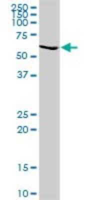 Western Blot: GALNT14 Antibody [H00079623-D01P] - Analysis of GALNT14 expression in human kidney.