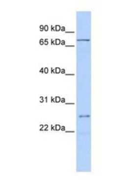 Western Blot: GALNT14 Antibody [NBP1-69611] - This Anti-GALNT14 antibody was used in Western Blot of OVCAR-3 tissue lysate at a concentration of 1ug/ml.