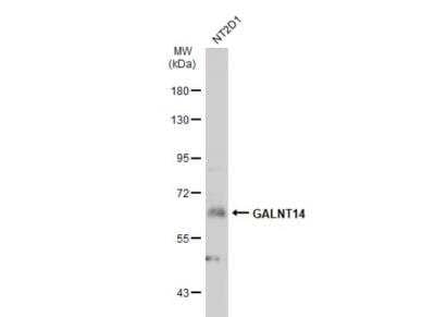 Western Blot: GALNT14 Antibody [NBP2-16595] - Whole cell extract (30 ug) were separated by 7.5% SDS-PAGE, and the membrane was blotted with GALNT14 antibody [N1N3]  diluted at 1:1000. The HRP-conjugated anti-rabbit IgG antibody (NBP2-19301) was used to detect the primary antibody, and the signal was developed with Trident ECL plus-Enhanced.