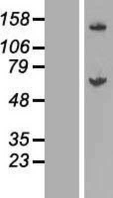 Western Blot: GALNT14 Overexpression Lysate (Adult Normal) [NBL1-10953] Left-Empty vector transfected control cell lysate (HEK293 cell lysate); Right -Over-expression Lysate for GALNT14.