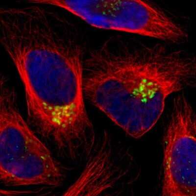 <b>Genetic Strategies Validation. </b>Immunocytochemistry/Immunofluorescence: GALNT2 Antibody [NBP1-83394] - Staining of human cell line U-2 OS shows localization to the Golgi apparatus. Antibody staining is shown in green.