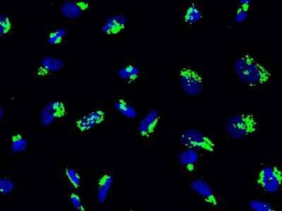 Immunocytochemistry/Immunofluorescence: GALNT2 Antibody [NBP3-00188] - Immunofluorescence staining of GALNT2 in HeLa cells. Cells were fixed with 4% PFA, permeabilzed with 0.3% Triton X-100 in PBS, blocked with 10% serum, and incubated with rabbit anti-human GALNT2 polyclonal antibody (1:1000) at 4C overnight. Then cells were stained with the Alexa Fluor(R)488-conjugated Goat Anti-rabbit IgG Secondary antibody (green) and counterstained with DAPI (blue). Positive staining was localized to cytoplasm.