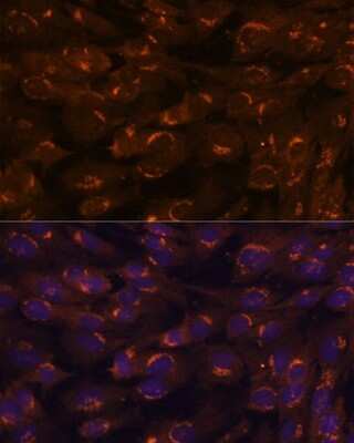 Immunocytochemistry/Immunofluorescence: GALNT2 Antibody [NBP3-05041] - Analysis of C6 cells using GALNT2 antibody at dilution of 1:100. Blue: DAPI for nuclear staining.