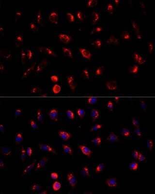 Immunocytochemistry/Immunofluorescence: GALNT2 Antibody [NBP3-05041] - Analysis of L929 cells using GALNT2 antibody at dilution of 1:100. Blue: DAPI for nuclear staining.