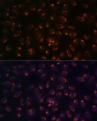 Immunocytochemistry/Immunofluorescence: GALNT2 Antibody [NBP3-05041] - Analysis of U-2 OS cells using GALNT2 antibody at dilution of 1:100. Blue: DAPI for nuclear staining.