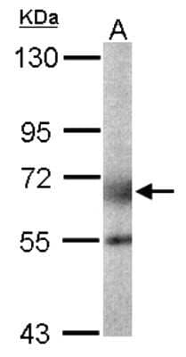 Western Blot: GALNT2 Antibody [NBP1-32394] - Sample (50 ug of whole cell lysate) A: Mouse white adipose tissue 7. 5% SDS PAGE; antibody diluted at 1:1000.