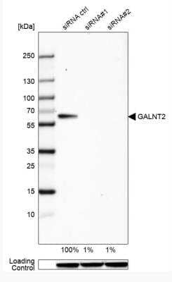 Western Blot: GALNT2 Antibody [NBP1-83394] - Analysis in HeLa cells transfected with control siRNA, target specific siRNA probe #1 and #2, using Anti-GALNT2 antibody. Remaining relative intensity is presented. Loading control: Anti-GAPDH.