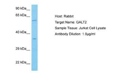 Western Blot: GALNT2 Antibody [NBP2-87483] - Host: Rabbit. Target Name: GALT2. Sample Type: Jurkat Whole Cell lysates. Antibody Dilution: 1.0ug/ml