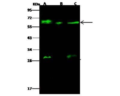 Western Blot: GALNT2 Antibody [NBP3-00188] - Anti-GALNT2 rabbit polyclonal antibody at 1:500 dilution. Lane A: A549 Whole Cell Lysate. Lane B: Hela Whole Cell Lysate. Lane C: U87MG Whole Cell Lysate. Lysates/proteins at 30 ug per lane. Secondary Goat Anti- Rabbit  IgG H&L (Dylight 800)  at 1/10000 dilution. Developed using the Odyssey technique. Performed under reducing conditions. Predicted band size: 65 kDa. Observed band size: 65 kDa (We are unsure as to the identity of these extra bands).