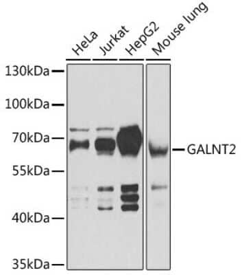 Western Blot: GALNT2 Antibody [NBP3-05041] - Analysis of extracts of various cell lines, using GALNT2 antibody at 1:1000 dilution. Secondary antibody: HRP Goat Anti-Rabbit IgG (H+L) at 1:10000 dilution. Lysates/proteins: 25ug per lane. Blocking buffer: 3% nonfat dry milk in TBST. Detection: ECL Basic Kit