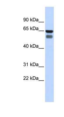 Western Blot: GALNT4 Antibody [NBP1-62381] - Human Stomach, concentration 0.2-1 ug/ml.