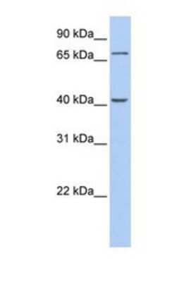 Western Blot: GALNT4 Antibody [NBP1-69399] - This Anti-GALNT4 antibody was used in Western Blot of Fetal Brain tissue lysate at a concentration of 1ug/ml.