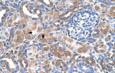 Immunohistochemistry: GALNT6 Antibody [NBP1-69641] - Human kidney.