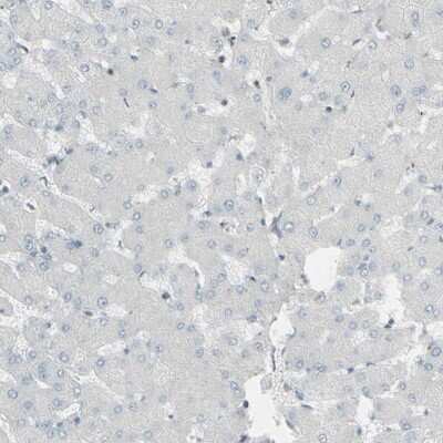 Immunohistochemistry-Paraffin: GALNT6 Antibody [NBP1-86100] - Staining of human liver shows low expression as expected.