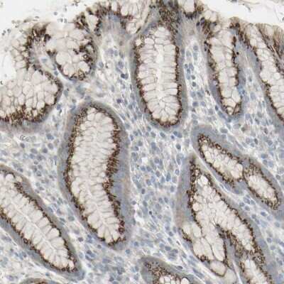 Immunohistochemistry-Paraffin: GALNT6 Antibody [NBP1-86100] - Staining of human stomach shows high expression.