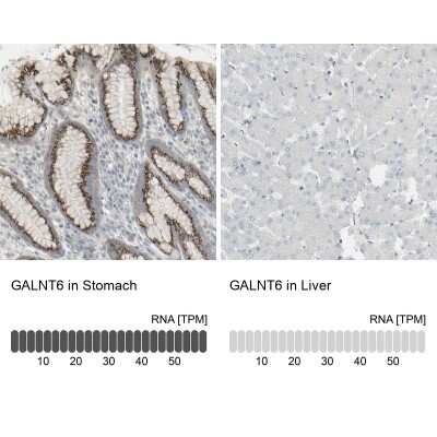 <b>Orthogonal Strategies Validation. </b>Immunohistochemistry-Paraffin: GALNT6 Antibody [NBP1-86100] - Staining in human stomach and liver tissues using anti-GALNT6 antibody. Corresponding GALNT6 RNA-seq data are presented for the same tissues.