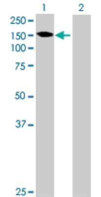 Western Blot: GALNT6 Antibody [H00011226-B01P] - Analysis of GALNT6 expression in transfected 293T cell line by GALNT6 polyclonal antibody.  Lane 1: GALNT6 transfected lysate(68.42 KDa). Lane 2: Non-transfected lysate.
