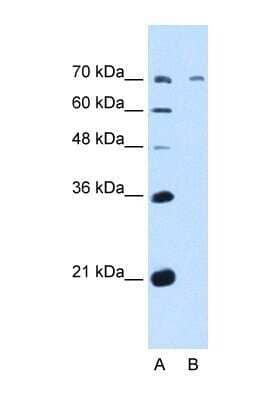 Western Blot: GALNT6 Antibody [NBP1-69641] - This Anti-GALNT6 antibody was used in Western Blot of HepG2 tissue lysate at a concentration of 5ug/ml.