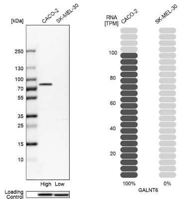 Western Blot GALNT6 Antibody