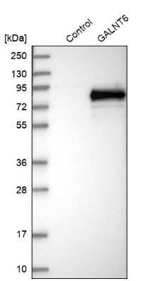 Western Blot: GALNT6 Antibody [NBP1-86100] - Analysis in control (vector only transfected HEK293T lysate) and GALNT6 over-expression lysate (Co-expressed with a C-terminal myc-DDK tag (3.1 kDa) in mammalian HEK293T cells).