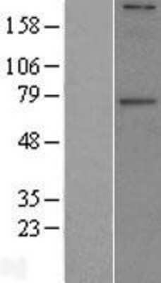 Western Blot: GALNT6 Overexpression Lysate (Adult Normal) [NBL1-10957] Left-Empty vector transfected control cell lysate (HEK293 cell lysate); Right -Over-expression Lysate for GALNT6.