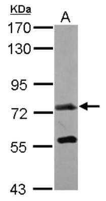 Western Blot: GALNT7 Antibody [NBP2-16597] - Sample (30 ug of whole cell lysate) A: MCF-7 7. 5% SDS PAGE gel, diluted at 1:1000.