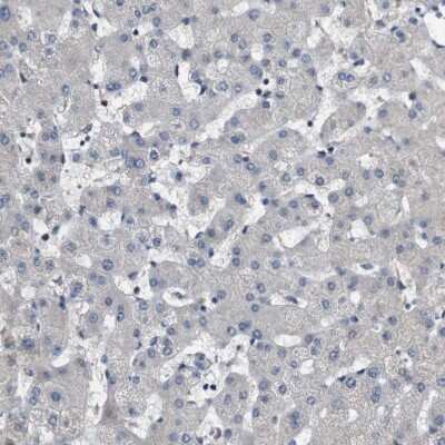 Immunohistochemistry-Paraffin GALNT8 Antibody