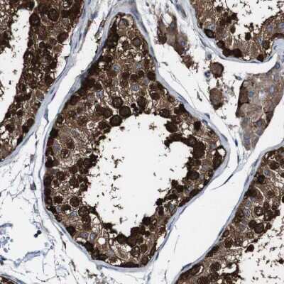 Immunohistochemistry-Paraffin GALNT8 Antibody