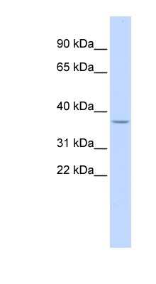 Western Blot: GALNT9 Antibody [NBP1-79313] - Titration: 0.2-1 ug/ml, Positive Control: Human kidney.