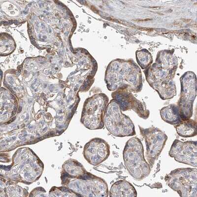 Immunohistochemistry-Paraffin: GALNTL6 Antibody [NBP1-81845] - Staining of human placenta shows moderate cytoplasmic positivity in trophoblastic cells.