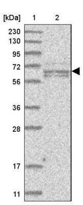 Western Blot: GALNTL6 Antibody [NBP1-81845] - Lane 1: Marker  [kDa] 230, 130, 95, 72, 56, 36, 28, 17, 11.  Lane 2: Human cell line RT-228