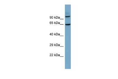 Western Blot GALNTL6 Antibody