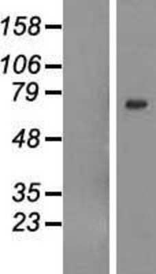 Western Blot GALNTL6 Overexpression Lysate