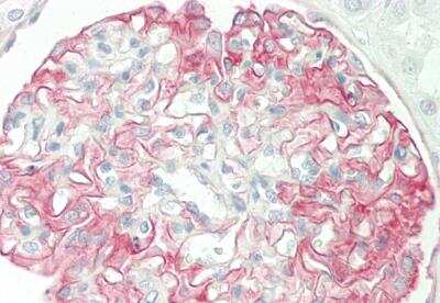 Immunohistochemistry-Paraffin: GALP Antibody [NBP2-84951] - Rabbit Anti-GALP antibody. Formalin Fixed Paraffin Embedded Tissue: Human Kidney. Primary antibody Concentration: 1:100. Secondary Antibody: Donkey anti-Rabbit-Cy3. Secondary Antibody Concentration: 1:200. Magnification: 20x. Exposure Time: 0.5-2.0sec