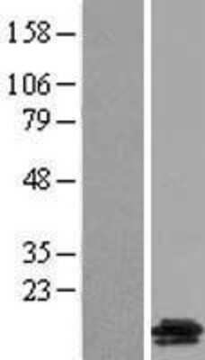 Western Blot: GALP Overexpression Lysate (Adult Normal) [NBL1-10961] Left-Empty vector transfected control cell lysate (HEK293 cell lysate); Right -Over-expression Lysate for GALP.