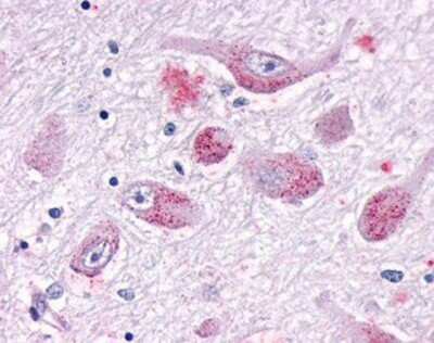 Immunohistochemistry-Paraffin: GALR1 Antibody [NLS4105] - Formalin-fixed paraffin section of human brain, stained (20 ug/ml)