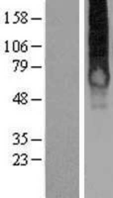 Western Blot: GALR1 Overexpression Lysate (Adult Normal) [NBP2-08207] Left-Empty vector transfected control cell lysate (HEK293 cell lysate); Right -Over-expression Lysate for GALR1.