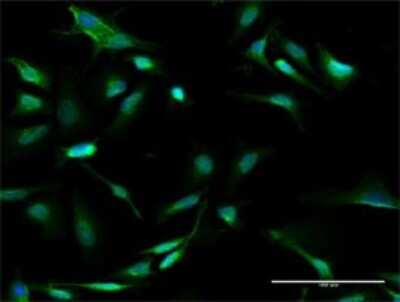 Immunocytochemistry/Immunofluorescence: GALT Antibody [H00002592-D01P] - Analysis of antibody to GALT on HeLa cell. Antibody concentration 30 ug/ml.