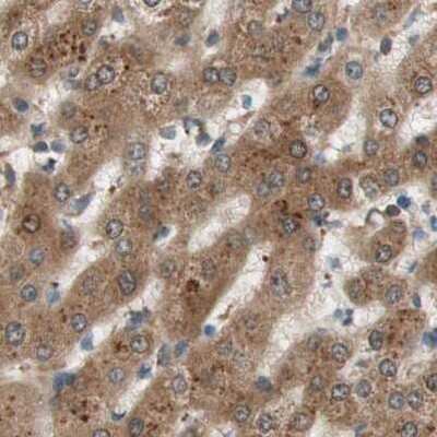 Immunohistochemistry-Paraffin: GALT Antibody [NBP1-86133] - Staining of human liver.