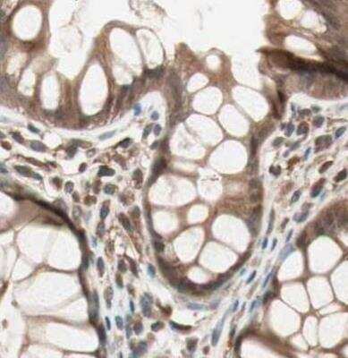 <b>Independent Antibodies Validation. </b>Immunohistochemistry-Paraffin: GALT Antibody [NBP1-86133] - Stainng of human colon.