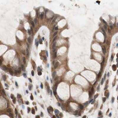 Immunohistochemistry-Paraffin: GALT Antibody [NBP1-86138] - Staining of human colon.